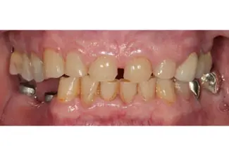Before image