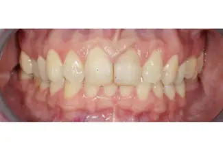 Before image
